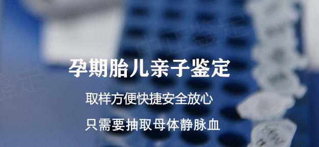 重庆如何办理胎儿亲子鉴定, 重庆如何办理胎儿亲子鉴定,
