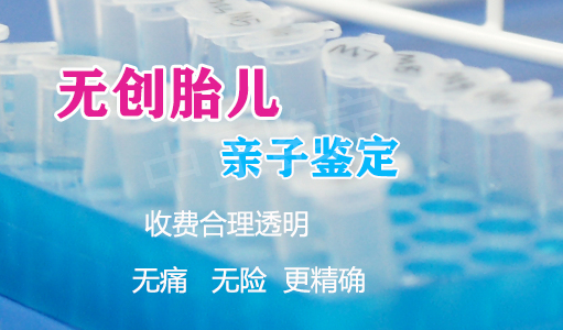 重庆孕期亲子鉴定流程,重庆孕期亲子鉴定机构预约流程