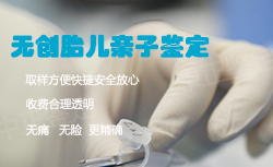 重庆怀孕如何做DNA鉴定，重庆怀孕办理亲子鉴定办理流程